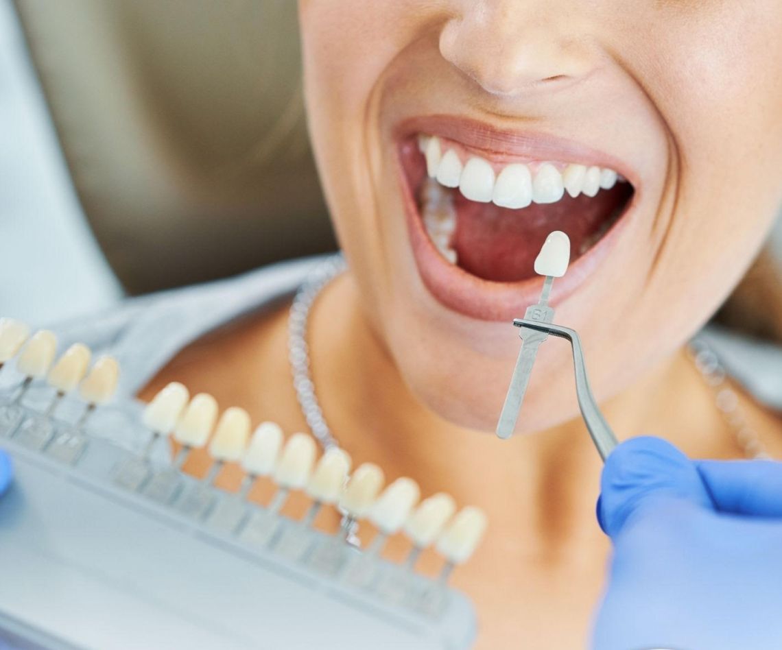 Special Offer on ZOOM! Home Teeth Whitening 